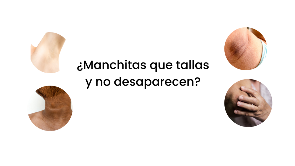 manchitas en la piela